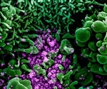 New coronavirus could potentially be treated with immunotherapy