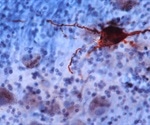 Biological age of the brain emerges as a powerful predictor of longevity