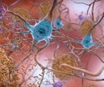 Neural organoids offer insight into mechanisms of dementia