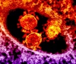 Severe Acute Respiratory Syndrome (SARS) overview