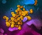 Findings into the source of the recent SARS outbreak in Beijing and Anhui Province