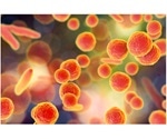 Pilot study aims for community pharmacists to provide optimal care to women with UTIs