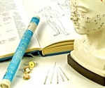 Does acupuncture relieve migraines?