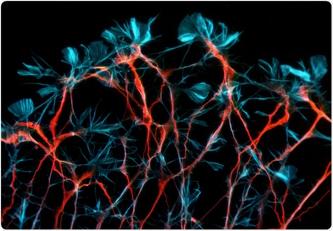 brain activity