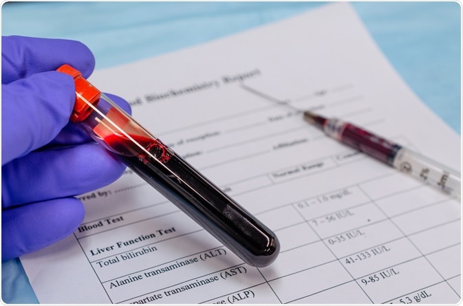 liver function test