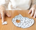 Biological age of the brain emerges as a powerful predictor of longevity