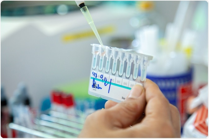 crossmatching