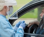 COVID19 patients describe a loss of smell and taste