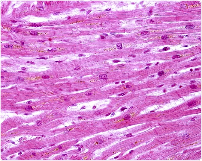 cardiac myocytes