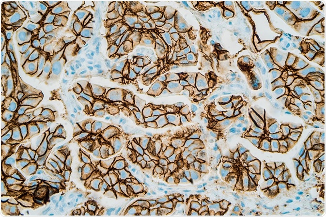 Immunohistochemistry Test Immunohistochemistry Test