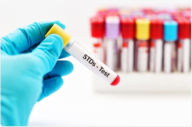 STD Test STD Test