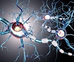 Small Animal Imaging Brings Insight to Neurodegenerative Disease
