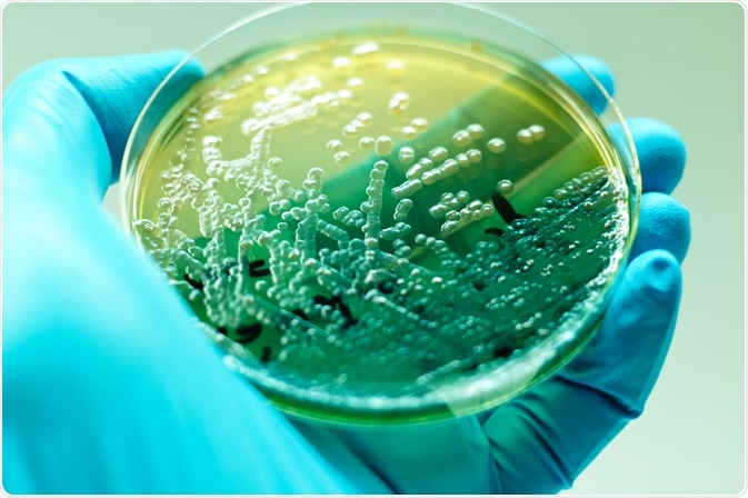 Pseudomonas aeruginosa