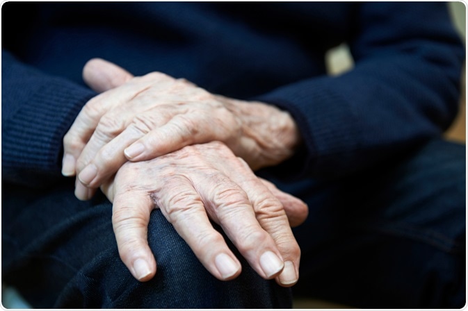 Parkinsons Disease