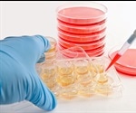 Why are Reporter-Labeled Cell Lines Useful?