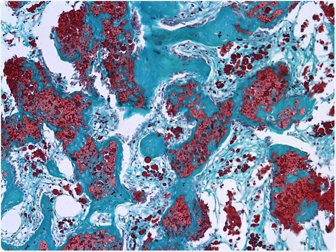 microparticles