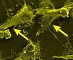 Are overactive immune cells causing COVID-19-related deaths?