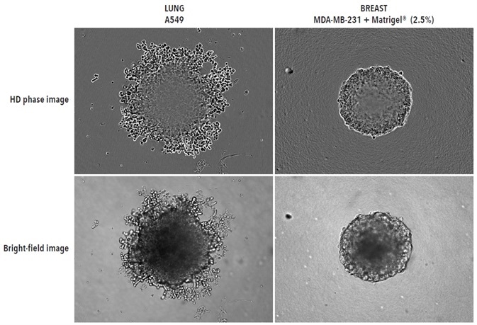 Visualizing different spheroid morphologies. High quality HD phase and corresponding BF images of spheroids formed from A549 and MDA-MB-231 cells (2,500 or 5000 cells per well respectively), 72-hours post seeding. Visualization of detailed phenotypic variation is observed in HD phase images. A549 cells present a loose aggregate morphology compared to the compact spheroid formed by MDA-MB-231 cells. Compaction of MDA-MB-231 aggregates into spheroids was achieved by the addition of 2.5% v/v Matrigel® post centrifugation. All images captured at 10x magnification. Visualizing different spheroid morphologies. High quality HD phase and corresponding BF images of spheroids formed from A549 and MDA-MB-231 cells (2,500 or 5000 cells per well respectively), 72-hours post seeding. Visualization of detailed phenotypic variation is observed in HD phase images. A549 cells present a loose aggregate morphology compared to the compact spheroid formed by MDA-MB-231 cells. Compaction of MDA-MB-231 aggregates into spheroids was achieved by the addition of 2.5% v/v Matrigel® post centrifugation. All images captured at 10x magnification.