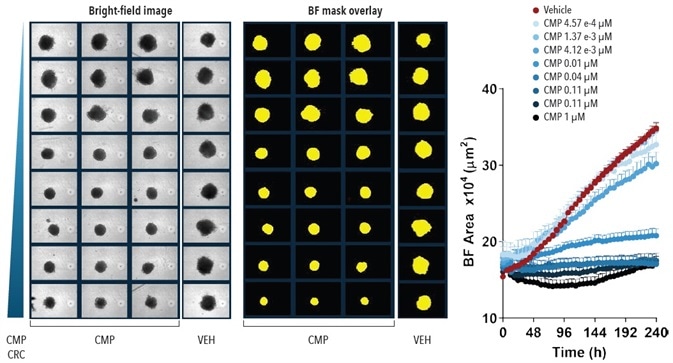 Quantification Spheroid Growth and Shrinkage. Effect of CMP on growth of A549 cells in a spheroid assay. A549 cells were plated at a density of 5,000 cells per well and spheroid allowed to form (72-hours). Serial dilutions of CMP were then added to the cells and the kinetics of spheroid growth and shrinkage were measured. Images represent the BF view and segmentation at Quantification Spheroid Growth and Shrinkage. Effect of CMP on growth of A549 cells in a spheroid assay. A549 cells were plated at a density of 5,000 cells per well and spheroid allowed to form (72-hours). Serial dilutions of CMP were then added to the cells and the kinetics of spheroid growth and shrinkage were measured. Images represent the BF view and segmentation at