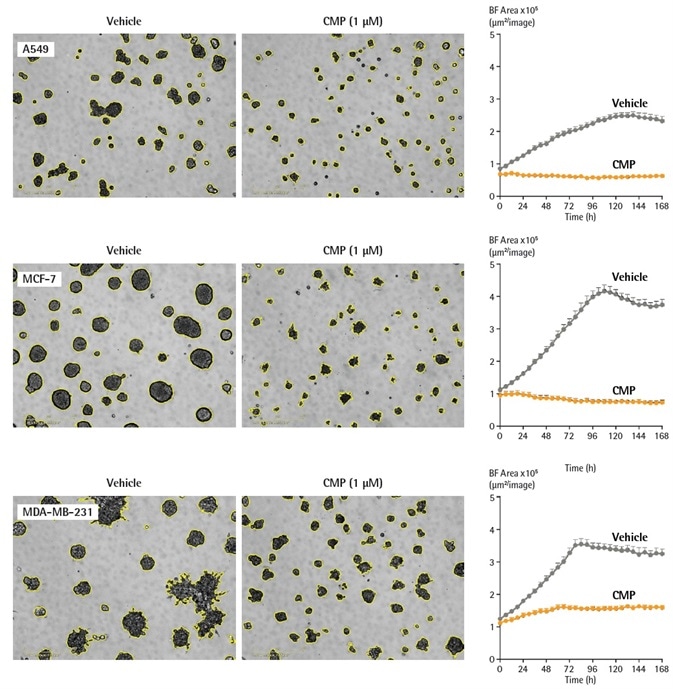 Quantification of cell-type dependent kinetic growth profiles of A549, MCF-7 and MDA-MB-231 spheroids using real time analysis. Cells were seeded in flat bottom 96-well plates (2,000 cells/well) on a bed of Matrigel and spheroids allowed to form (72 h). Spheroids were treated with either vehicle (0.1% DMSO) or CMP (1 µM). Segmented (yellow outline) DF-Brightfield images compare vehicle or CMP treated conditions at 168 h. Morphological differences are shown between round (A549, MCF-7) and stellate (MDA-MB-231) spheroids. Time courses show the individual well Total Brightfield Object Area (µm2) (y-axis) over 168 h and illustrate cell type specific kinetic growth profiles. Data were collected over 168 h period at 6 h intervals. All images captured at 10x magnification. Each data point represents mean ± SEM, Quantification of cell-type dependent kinetic growth profiles of A549, MCF-7 and MDA-MB-231 spheroids using real time analysis. Cells were seeded in flat bottom 96-well plates (2,000 cells/well) on a bed of Matrigel and spheroids allowed to form (72 h). Spheroids were treated with either vehicle (0.1% DMSO) or CMP (1 µM). Segmented (yellow outline) DF-Brightfield images compare vehicle or CMP treated conditions at 168 h. Morphological differences are shown between round (A549, MCF-7) and stellate (MDA-MB-231) spheroids. Time courses show the individual well Total Brightfield Object Area (µm2) (y-axis) over 168 h and illustrate cell type specific kinetic growth profiles. Data were collected over 168 h period at 6 h intervals. All images captured at 10x magnification. Each data point represents mean ± SEM,