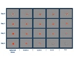 Immune Cells Killing 3D Tumor Spheroids in 96-Well Live-Cell Assay