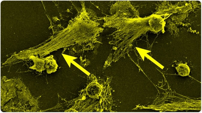 Part of the body