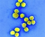 Remdesivir shows powerful activity against SARS-CoV-2 in Vitro