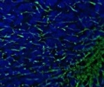 Next-Generation Microscopy Image Analysis with Deep-Learning Technology