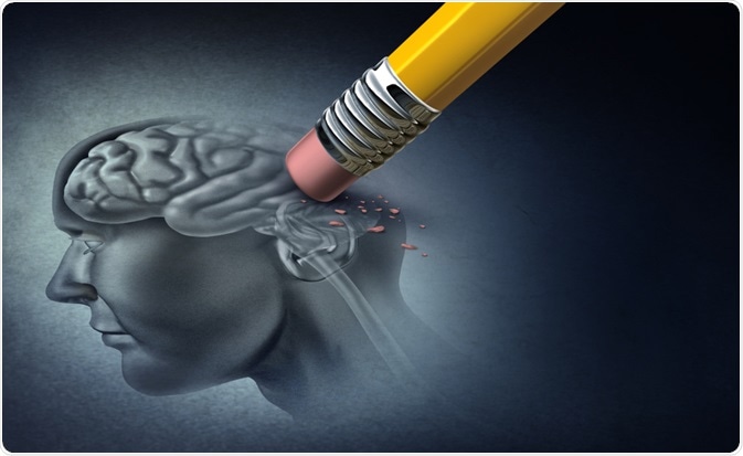 Memory Loss Concept Memory Loss Concept