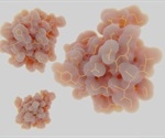How Does Insulin Affect the Brain?