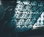 Identifying Brain Damage from Blood Tests