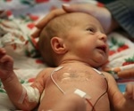Microfluidic Systems for Sweat Analysis and Neonatal Care