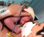 Impact of COVID-19 on pregnancy and breastfed infants