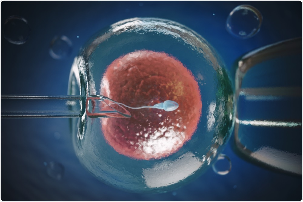 IVF