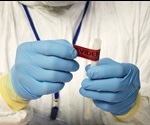 Organ Donation and Forensic Investigation