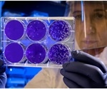 Rapid point-of-care testing using screen-printed electrodes from Metrohm DropSens