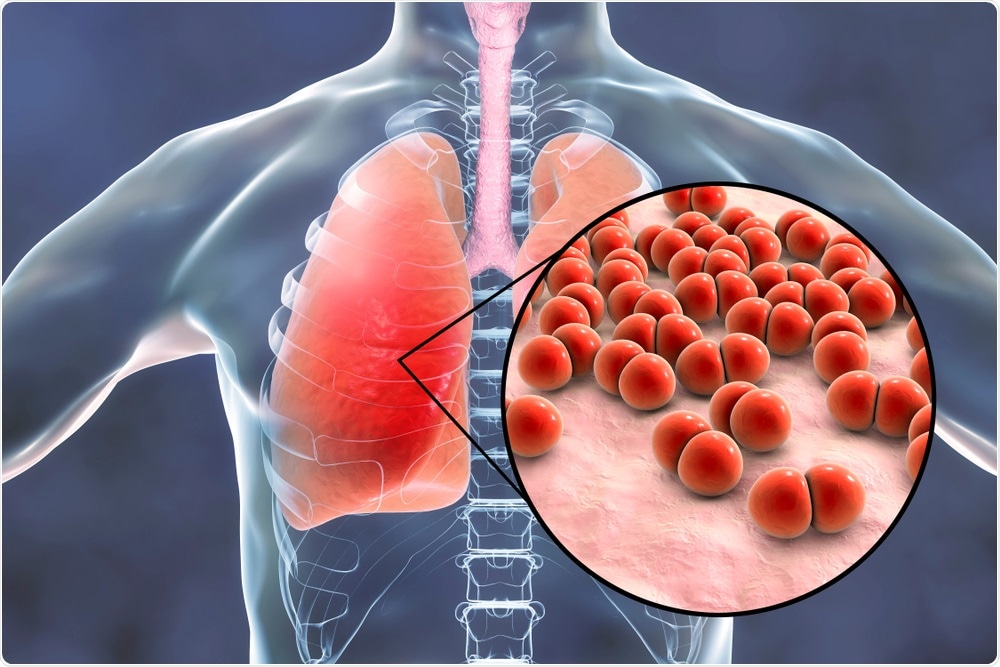 Pneumonia