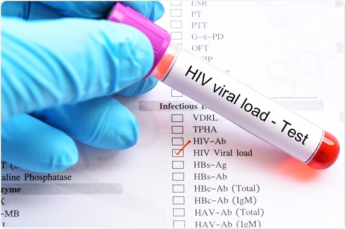 Viral Load Viral Load