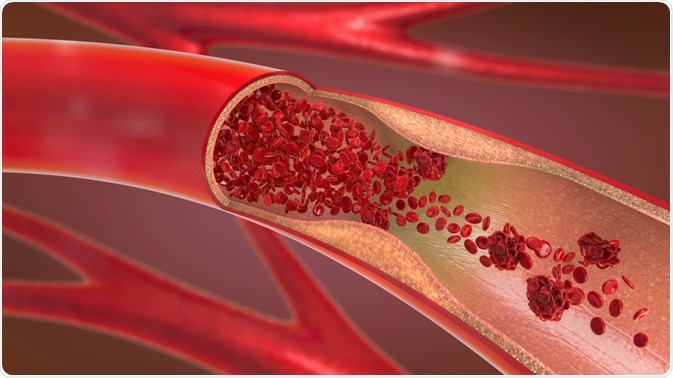 arteries