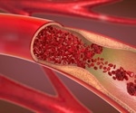 What is PET/Angio-CT?