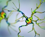 Parkinson's disease breakthrough seen in mouse model