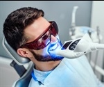What Foods Should be Avoided After Teeth Whitening?