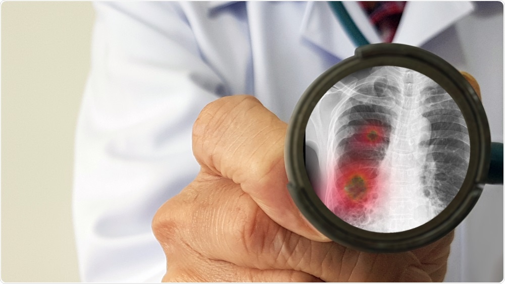 Infectious Diseases Doctor