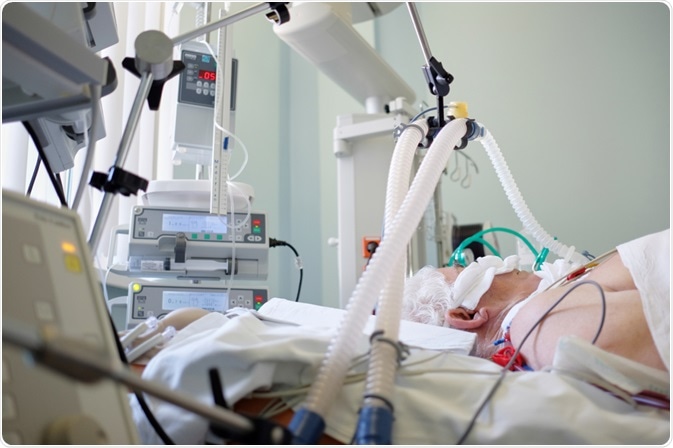Ventilator
