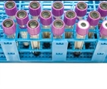 A Self-Mixing Interferometry-Based Micro Flow Cytometry System