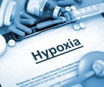 Silent hypoxia and its role in COVID-19 detection