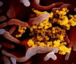 New platform prioritizes synergistic drug combinations against SARS-CoV-2