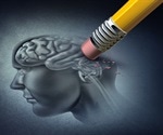 Ten major risk factors for Alzheimer's disease