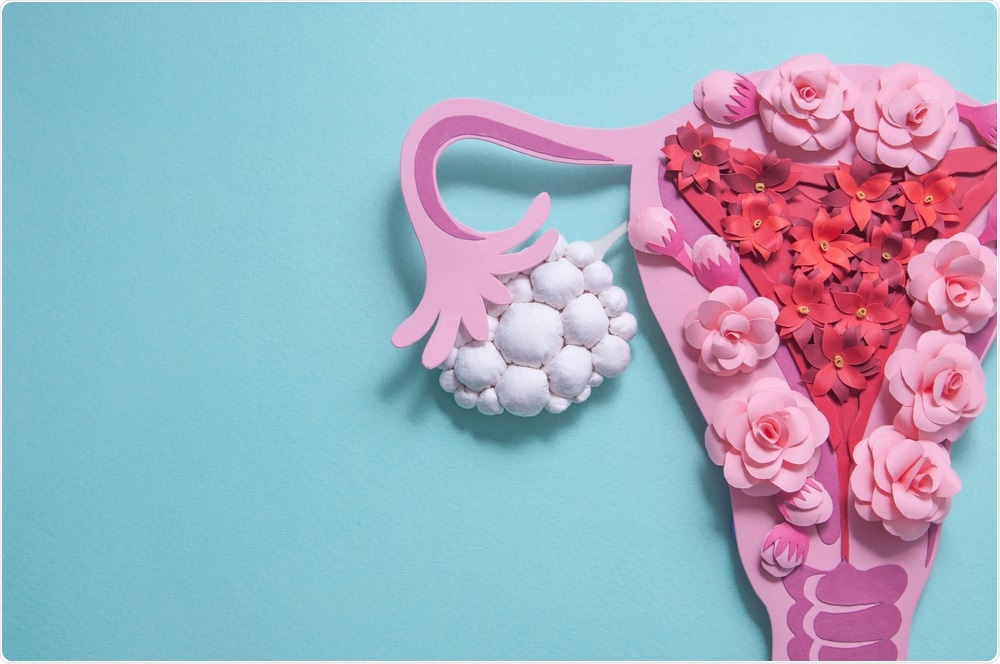 Polycystic Ovary Syndrome Polycystic Ovary Syndrome