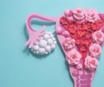 Developing a Better Understanding of Polycystic Ovary Syndrome (PCOS)